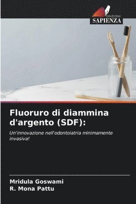 Fluoruro di diammina d'argento (SDF) 1