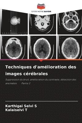 bokomslag Techniques d'amelioration des images cerebrales