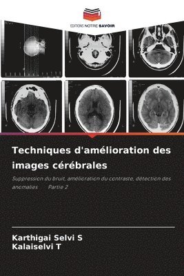 Techniques d'amelioration des images cerebrales 1