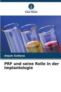 bokomslag PRF und seine Rolle in der Implantologie