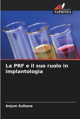 bokomslag La PRF e il suo ruolo in implantologia