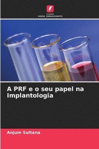 bokomslag A PRF e o seu papel na Implantologia