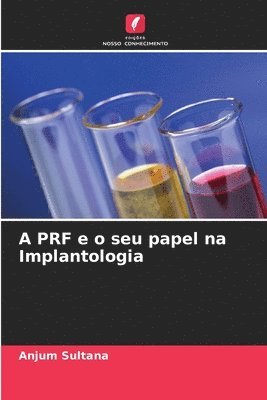 A PRF e o seu papel na Implantologia 1