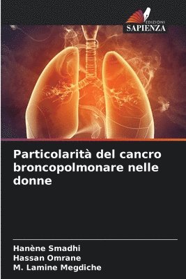 bokomslag Particolarit del cancro broncopolmonare nelle donne