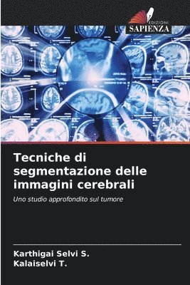 Tecniche di segmentazione delle immagini cerebrali 1