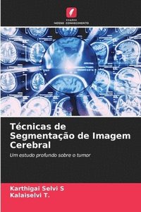 bokomslag Tcnicas de Segmentao de Imagem Cerebral