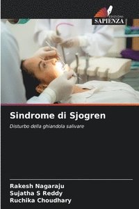 bokomslag Sindrome di Sjogren