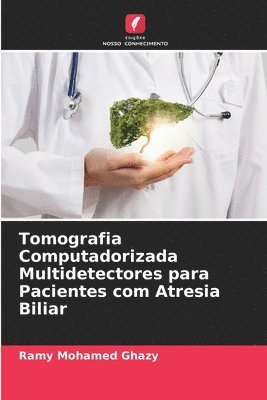 Tomografia Computadorizada Multidetectores para Pacientes com Atresia Biliar 1