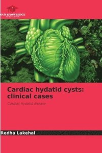 bokomslag Cardiac hydatid cysts