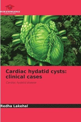 Cardiac hydatid cysts 1