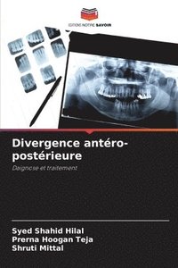 bokomslag Divergence antero-posterieure