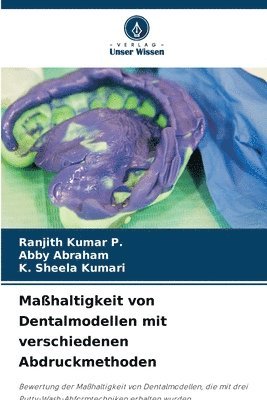 Mahaltigkeit von Dentalmodellen mit verschiedenen Abdruckmethoden 1