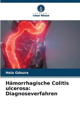 bokomslag Hämorrhagische Colitis ulcerosa: Diagnoseverfahren