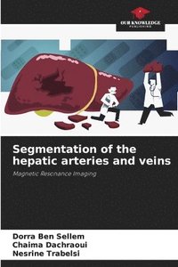 bokomslag Segmentation of the hepatic arteries and veins