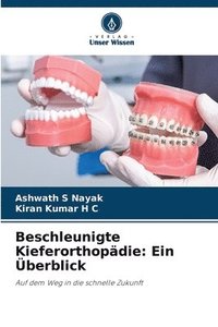 bokomslag Beschleunigte Kieferorthopdie