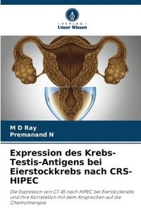 bokomslag Expression des Krebs-Testis-Antigens bei Eierstockkrebs nach CRS-HIPEC