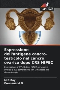 bokomslag Espressione dell'antigene cancro-testicolo nel cancro ovarico dopo CRS HIPEC