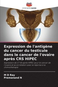 bokomslag Expression de l'antigne du cancer du testicule dans le cancer de l'ovaire aprs CRS HIPEC