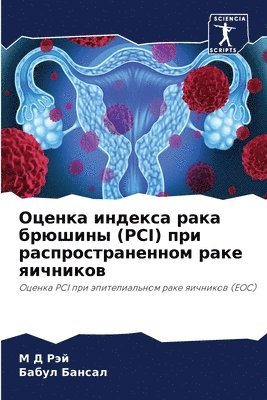 &#1054;&#1094;&#1077;&#1085;&#1082;&#1072; &#1080;&#1085;&#1076;&#1077;&#1082;&#1089;&#1072; &#1088;&#1072;&#1082;&#1072; &#1073;&#1088;&#1102;&#1096;&#1080;&#1085;&#1099; (Pci) &#1087;&#1088;&#1080; 1