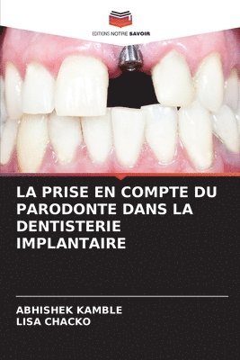 bokomslag La Prise En Compte Du Parodonte Dans La Dentisterie Implantaire