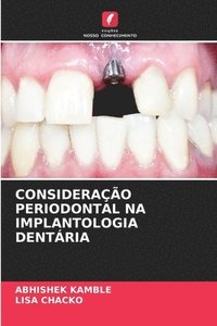 bokomslag Considerao Periodontal Na Implantologia Dentria