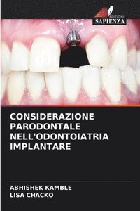 bokomslag Considerazione Parodontale Nell'odontoiatria Implantare