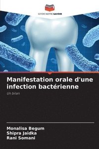 bokomslag Manifestation orale d'une infection bactrienne