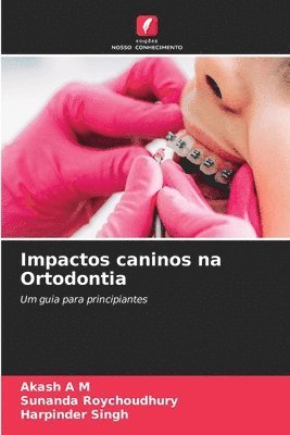 bokomslag Impactos caninos na Ortodontia