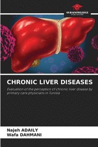 bokomslag Chronic Liver Diseases