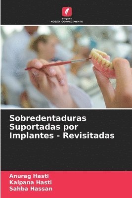 Sobredentaduras Suportadas por Implantes - Revisitadas 1