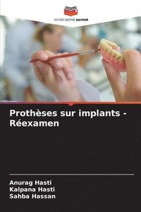 bokomslag Prothses sur implants - Rexamen