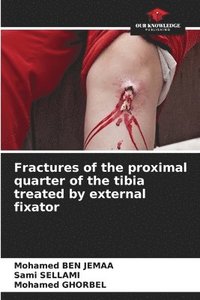 bokomslag Fractures of the proximal quarter of the tibia treated by external fixator