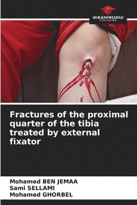 Fractures of the proximal quarter of the tibia treated by external fixator 1