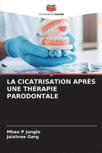 bokomslag La Cicatrisation Aprs Une Thrapie Parodontale