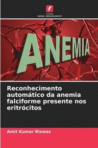 bokomslag Reconhecimento automtico da anemia falciforme presente nos eritrcitos