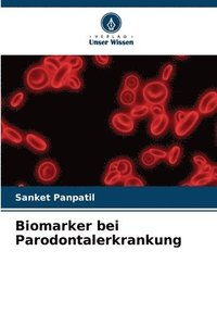 bokomslag Biomarker bei Parodontalerkrankung