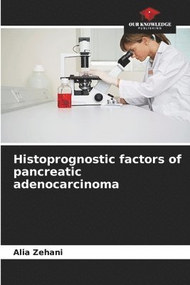 Histoprognostic factors of pancreatic adenocarcinoma 1