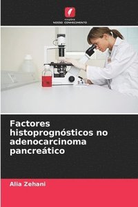 bokomslag Factores histoprognsticos no adenocarcinoma pancretico