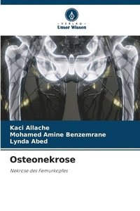 bokomslag Osteonekrose