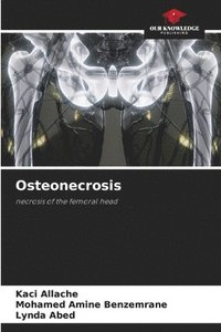 bokomslag Osteonecrosis