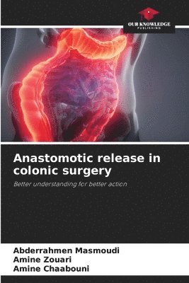 bokomslag Anastomotic release in colonic surgery