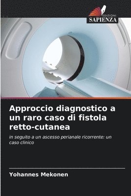 Approccio diagnostico a un raro caso di fistola retto-cutanea 1