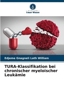 TURA-Klassifikation bei chronischer myeloischer Leukmie 1