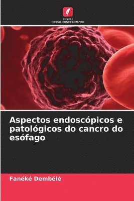 Aspectos endoscpicos e patolgicos do cancro do esfago 1