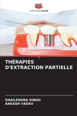 Thrapies d'Extraction Partielle 1