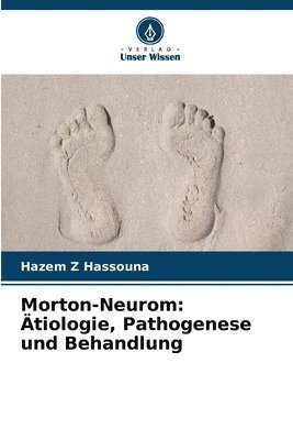 Morton-Neurom 1