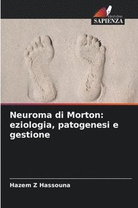 bokomslag Neuroma di Morton