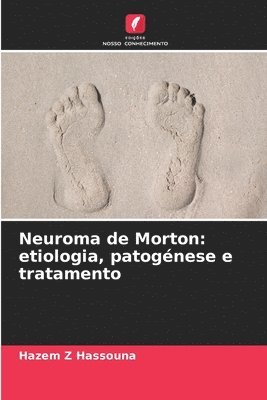 Neuroma de Morton 1