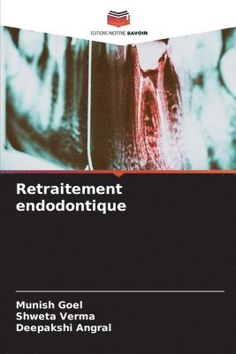 Retraitement endodontique 1