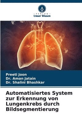 Automatisiertes System zur Erkennung von Lungenkrebs durch Bildsegmentierung 1